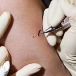 How to Stop Shaking When Getting a Tattoo